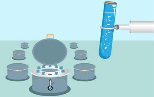 年龄大了精子数量会减少吗,精子数量怎么突然下降了