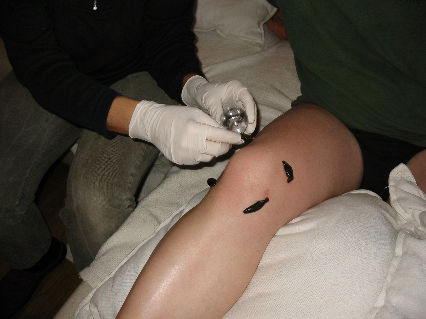 被蚂蟥钻身体里到底有多恐怖,蚂蝗能进入人的大脑里吗