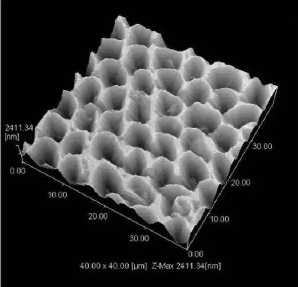 三种习惯让宝宝烂牙,宝宝烂牙是怎么回事