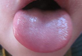 宝宝舌苔怎么辨别热还是寒,如何看宝宝舌苔来区别是否感冒