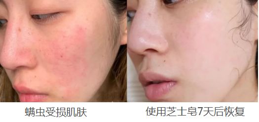 金晨种草的产品,金晨推荐除螨好物