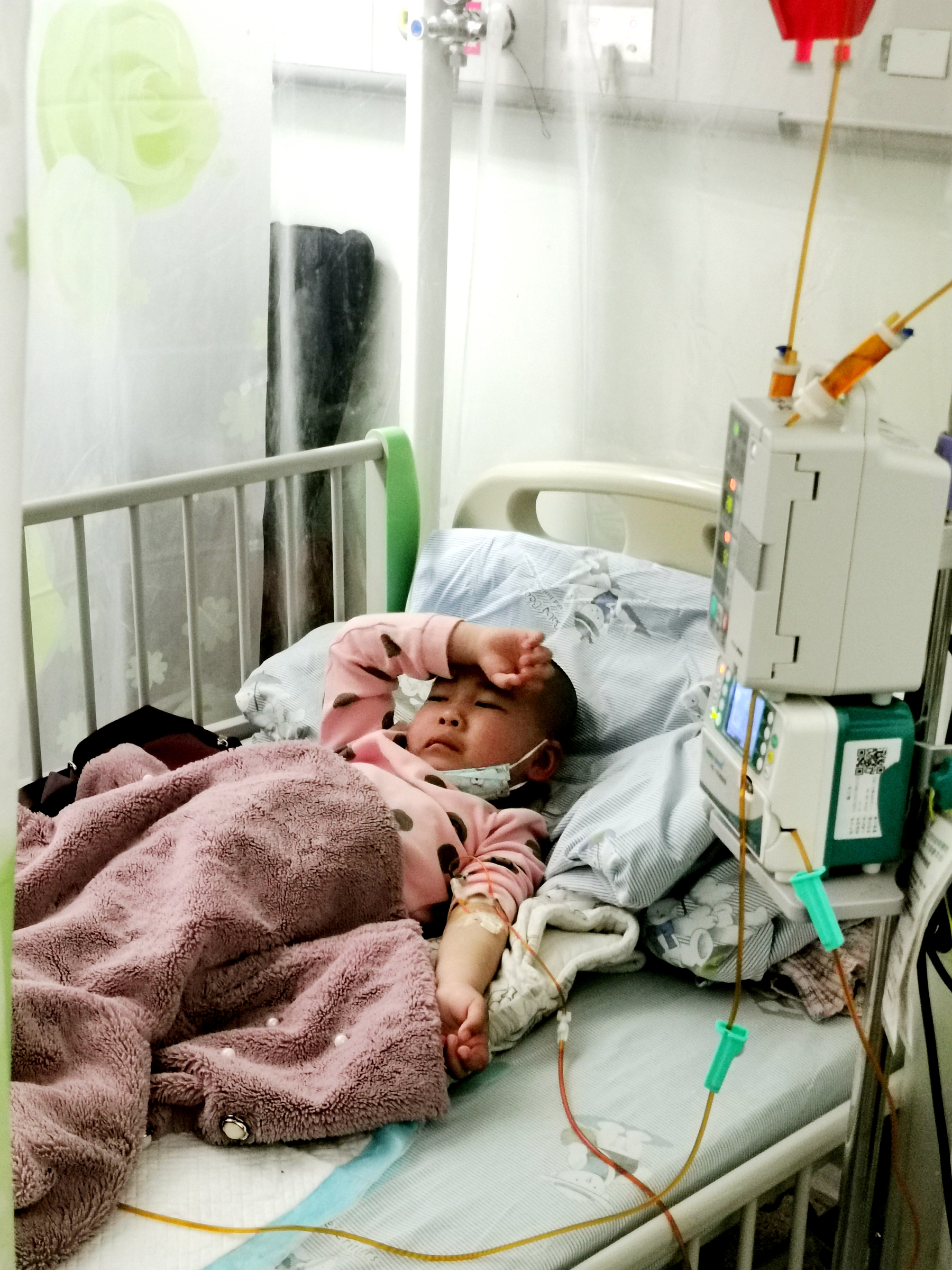 湖北4岁女孩生病致脸部毁容，需“割肉”治疗，爸爸门外放声大哭