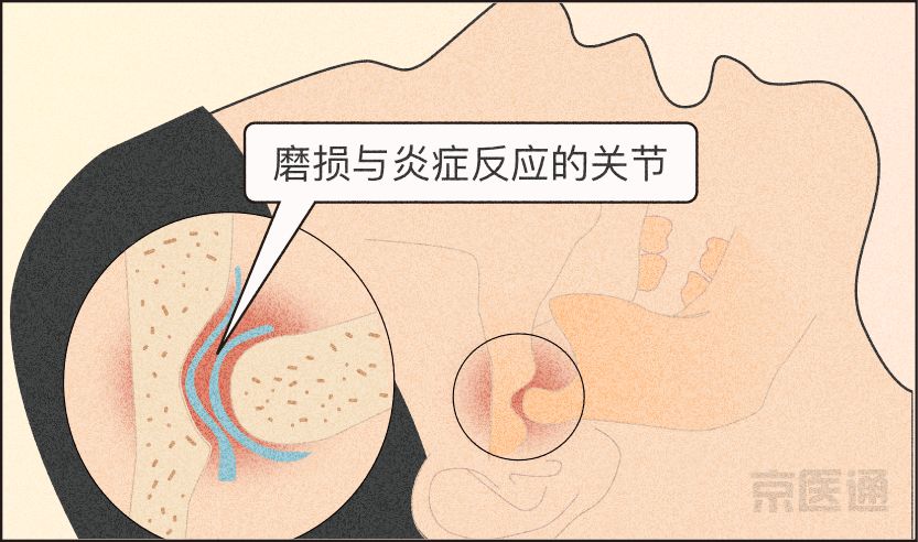 磨牙不好是真的吗,磨牙的危害与注意事项