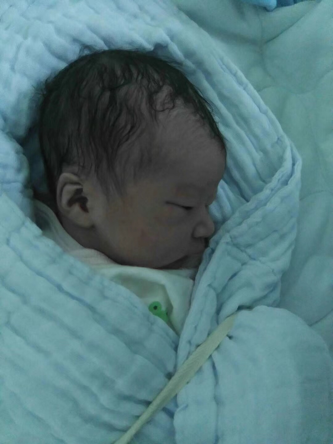 无侧切无撕裂的顺产经历。附送20多年产科主任医生的...