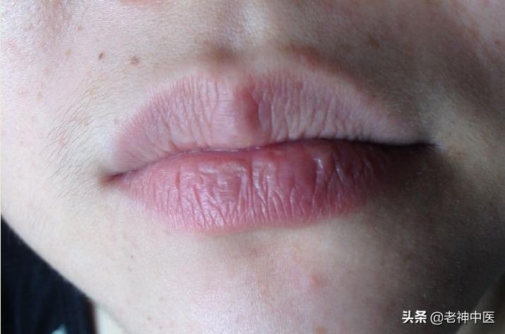 「中医案例」中医治愈糖尿病肾病，案例分析；糖尿病肾病如何分期