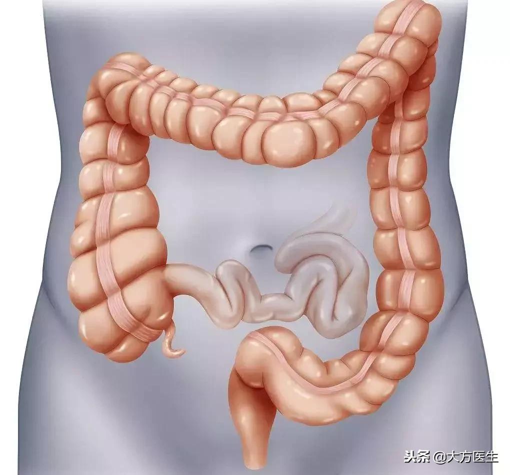 结直肠癌便血症状,便血是肠癌的几率有多大