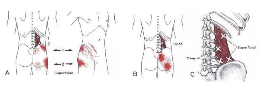 瑜伽初学者腰肌劳损怎么练习腰部,瑜伽腰背部疼痛怎么办