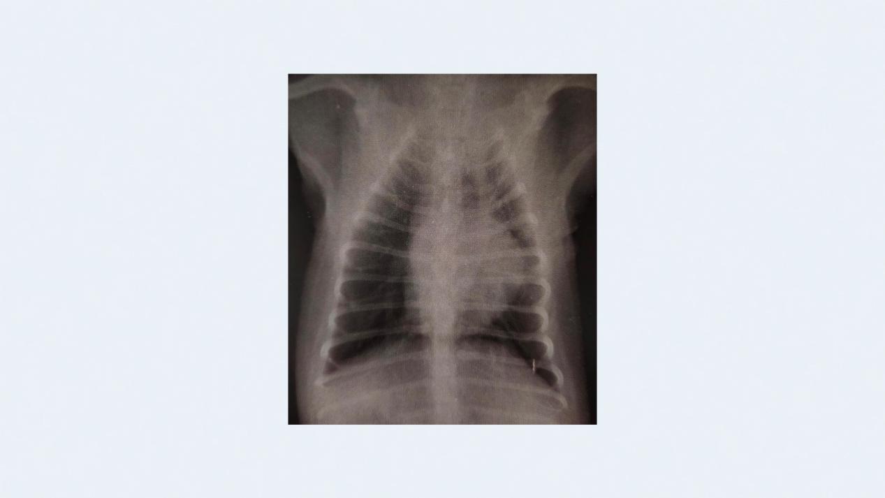 犬传染性支气管炎症状表现图片,牧羊犬有支气管炎怎么治