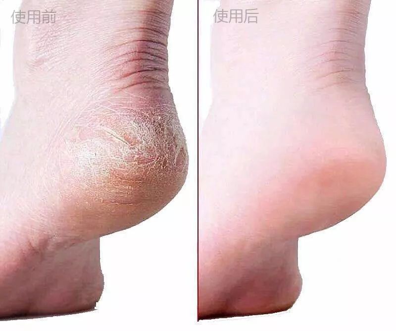 王鸥的气质和魅力是靠她的着装吗,王鸥私服明媚又惬意又优雅的感觉