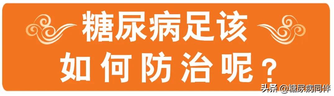糖尿病足烂脚前有6个症状,糖尿病足早期症状如何治疗