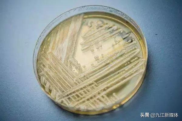 真菌感染一览表,最可怕的真菌感染