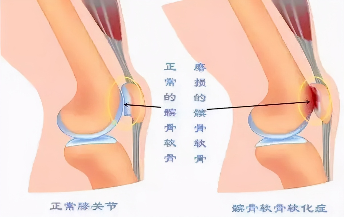 孙怡现实中的腿,孙怡的腿到底直不直