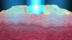 激光祛斑十五年以后再点斑可以吗,脸上长斑真的可以治好吗