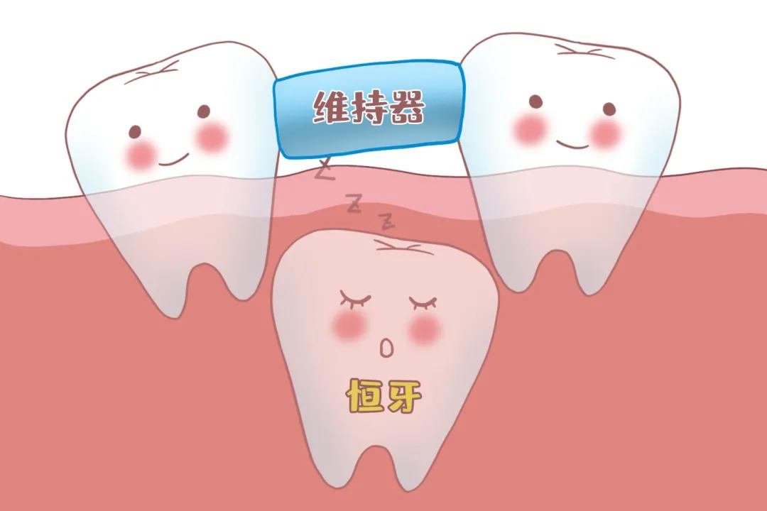 姚晨自曝儿子换牙问题,很多孩子中招!牙齿健康,家长们都要注意