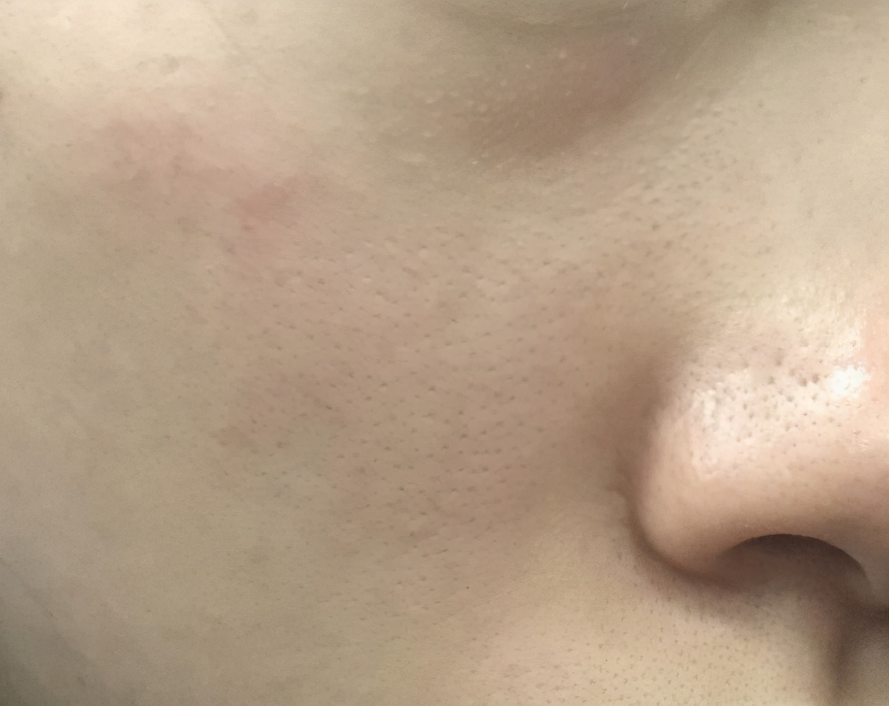 新手刷脂一个月的变化,干皮新手a醇精华