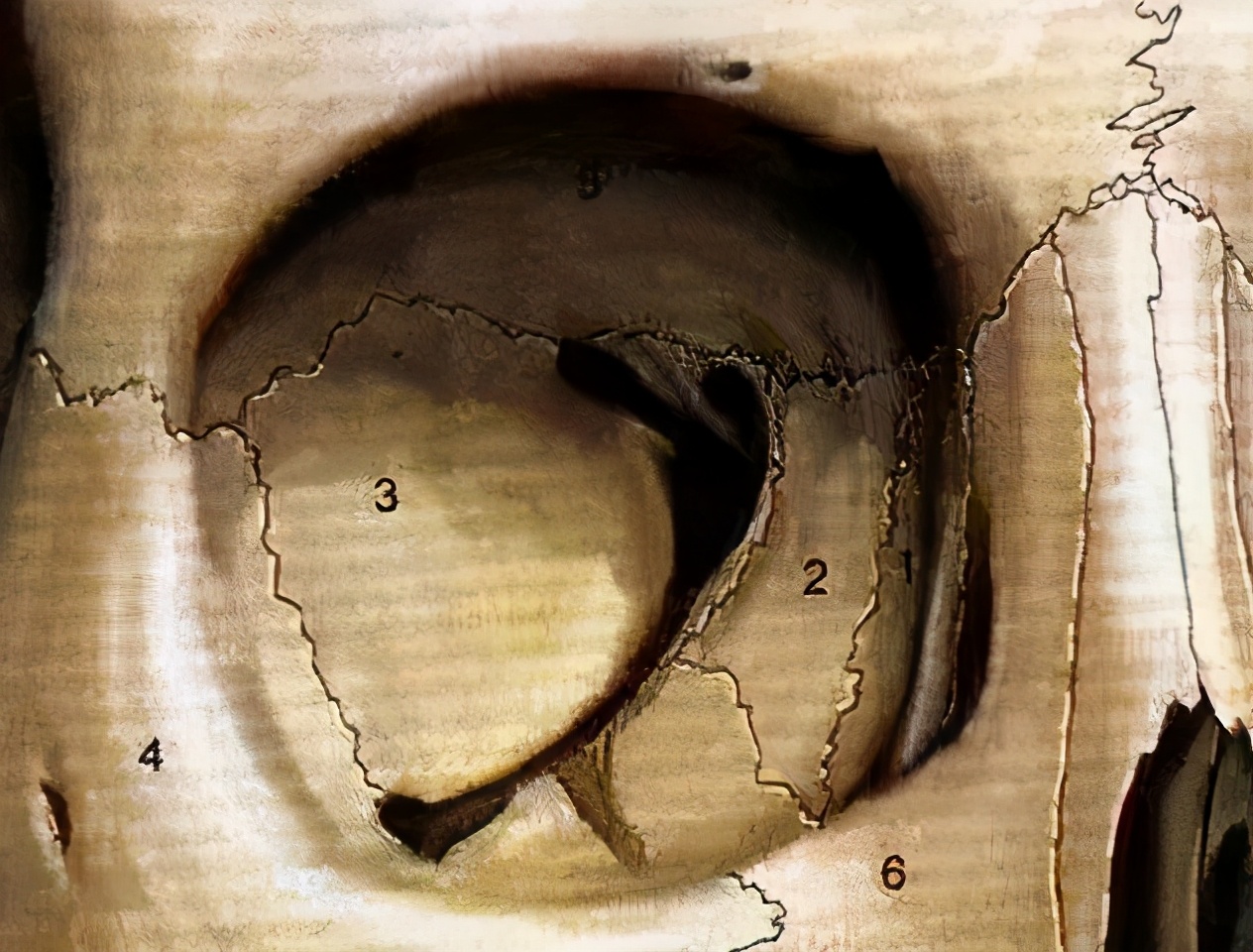 欧式双眼皮好看吗真的适合你吗,纯天然欧式双眼皮