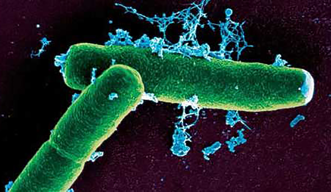 中国哪三大火腿它们的区别是什么,东西方火腿的区别