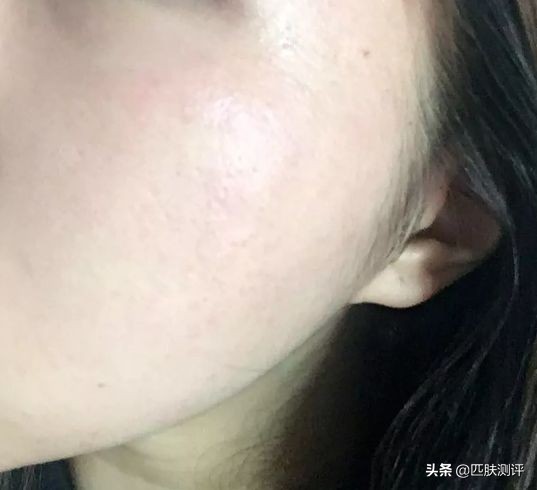 激光美容仪推荐,家用激光美容仪测评