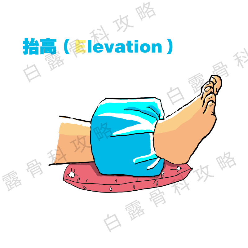 崴脚后48小时紧急处理,崴到脚紧急处理