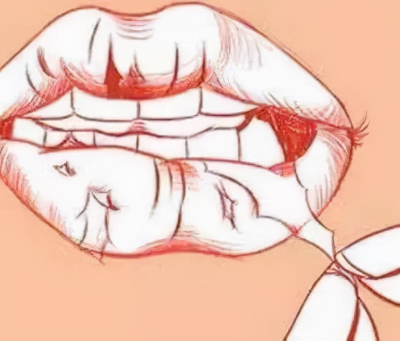 嘴唇变丑的十大坏习惯,这几个习惯会使嘴唇变得越来越厚