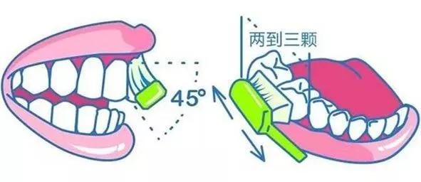 刷牙草草结束，不认真刷，最后可能就会变成这样子