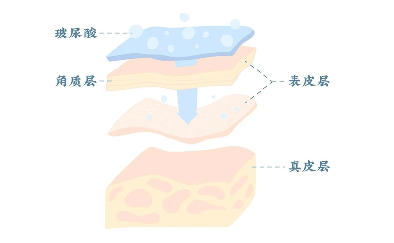 玻尿酸为什么这么牛逼,玻尿酸真的能护肤嘛