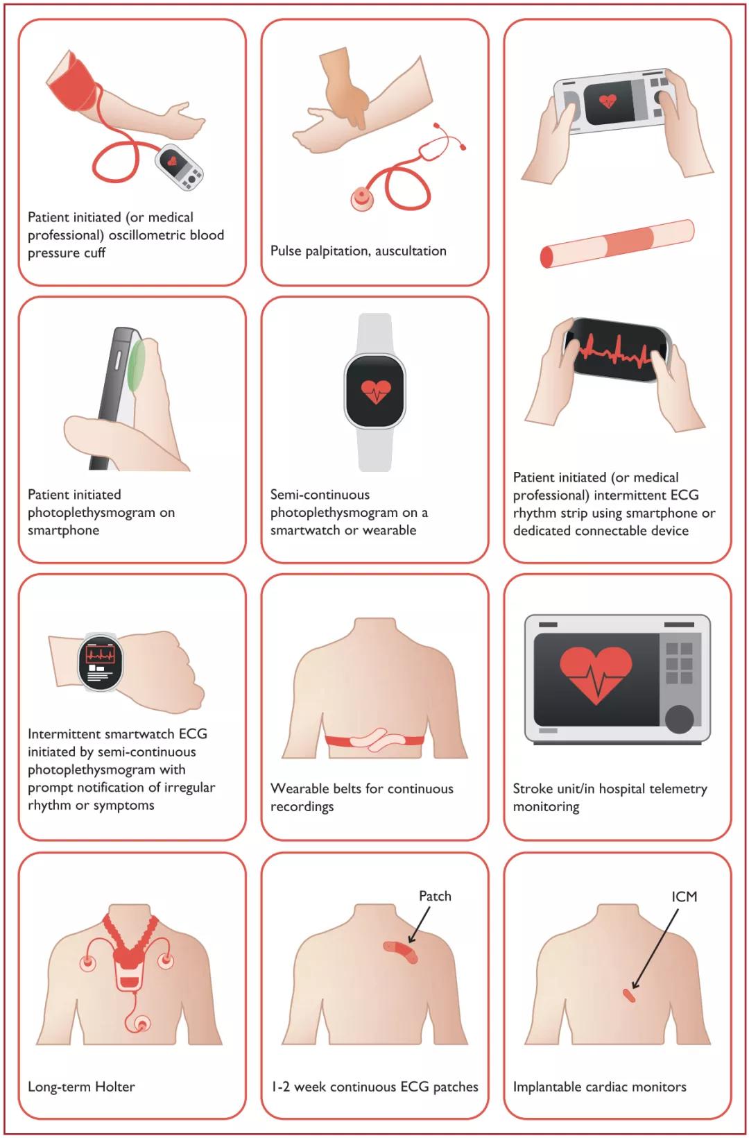 2020年欧洲心脏病学会房颤指南,国际最新房颤标准
