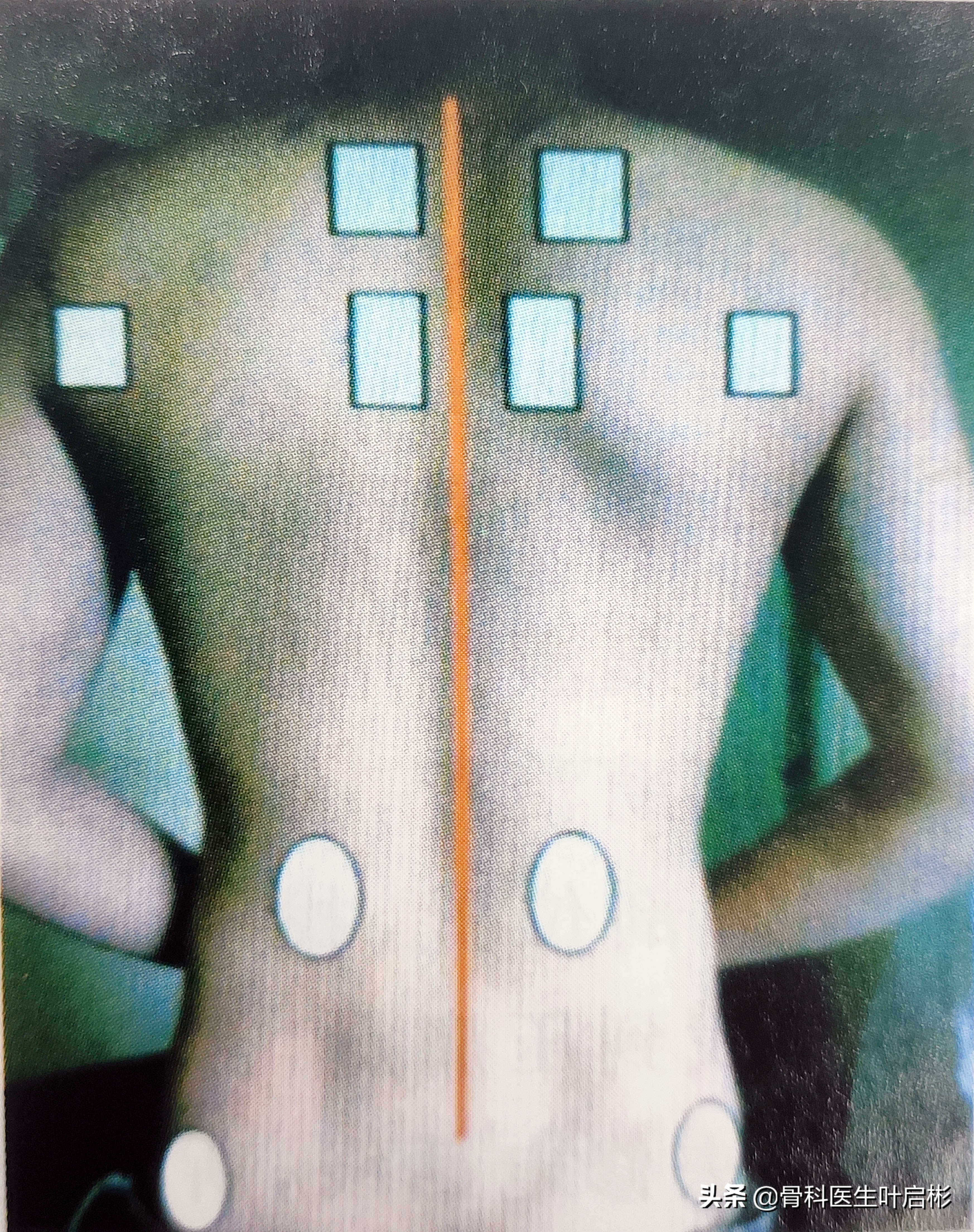 经常背痛贴的膏药,背酸痛贴膏药有用吗