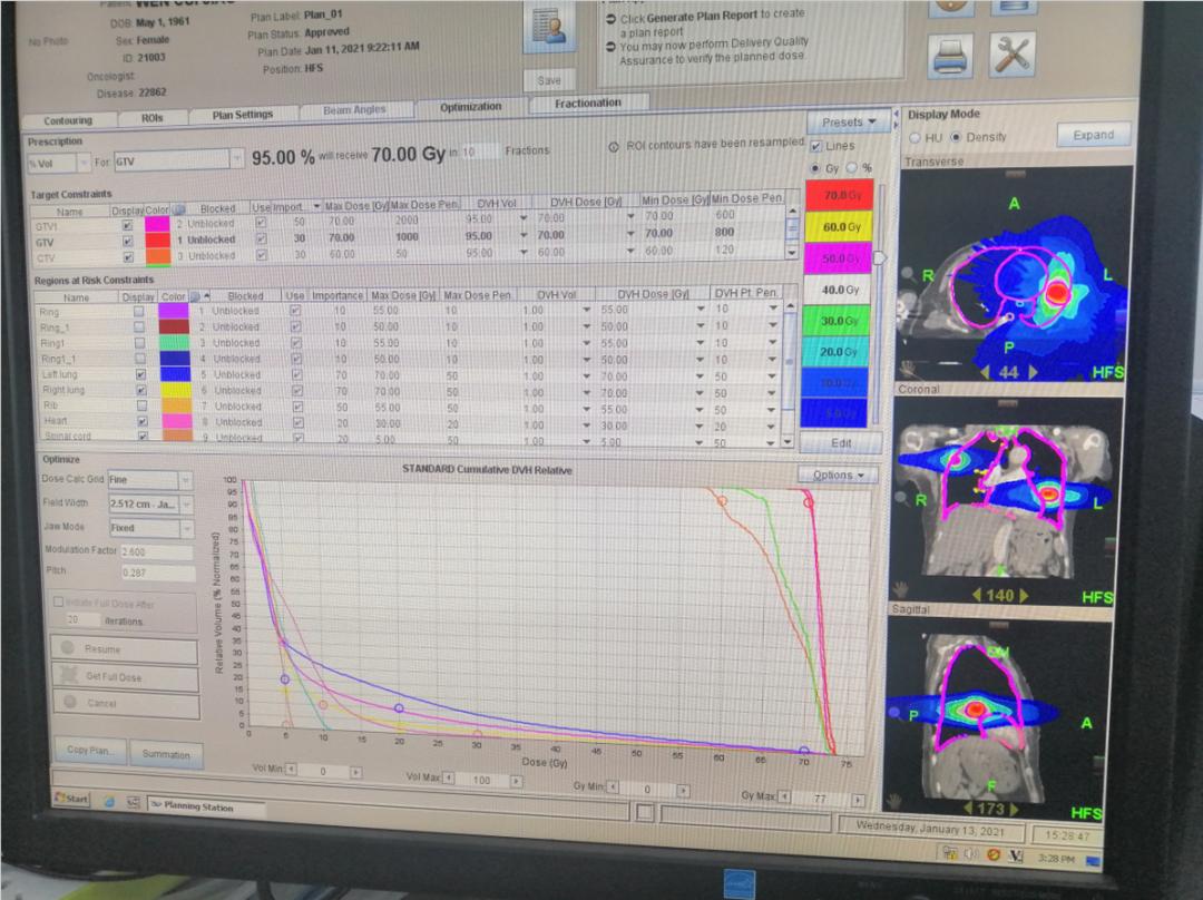 精准放疗的核心人物——物理师