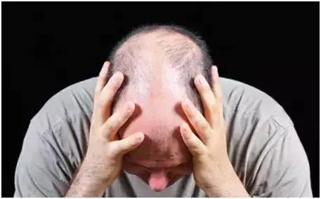 染发后脱发掉发严重的视频,染发导致休止期脱发怎么办