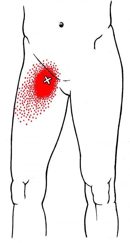康复训练手法干货分享,康复治疗师肌肉