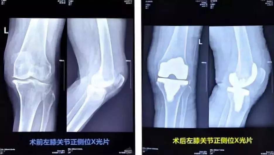 吴鹏程康复医院,吴鹏程金谷康复医院