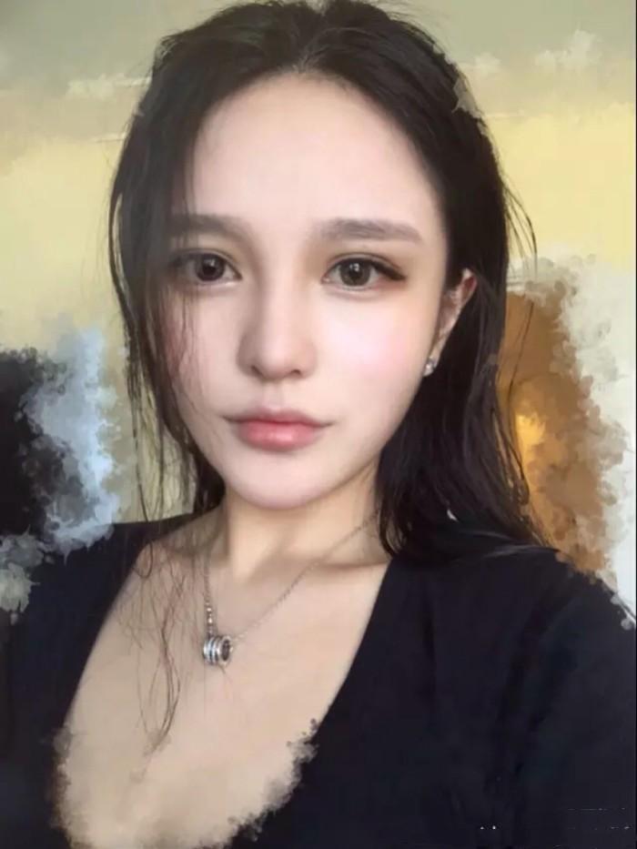 项思醒眼部整容史,项思醒整容了吗