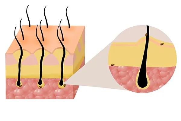 床上有螨虫用什么除螨药最好,床上如果有螨虫会怎么样