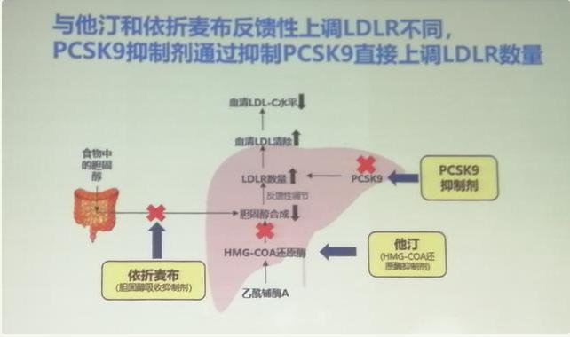 联合用药,助力冠心病患者低密度脂蛋白(LDL)尽早达标