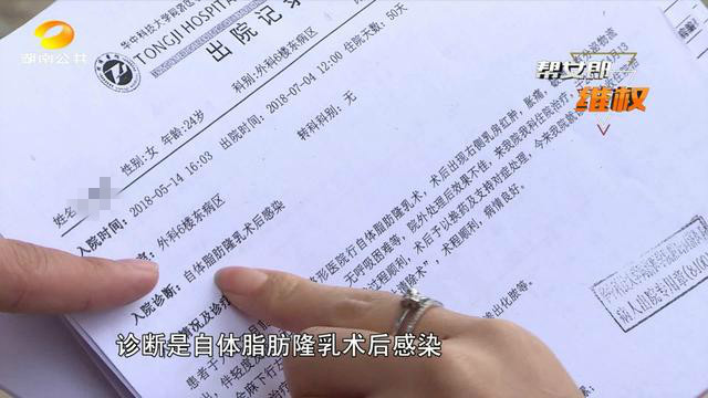 中国女子为了变美做隆胸手术,女人为了变美去做隆胸手术