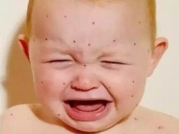 仔猪身上有出血点和结痂是什么病,孩子总是有一两个出血点反反复复