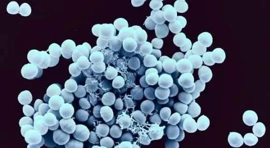 胶水冻住怎么样快速化解,石灰冻住怎么快速解冻