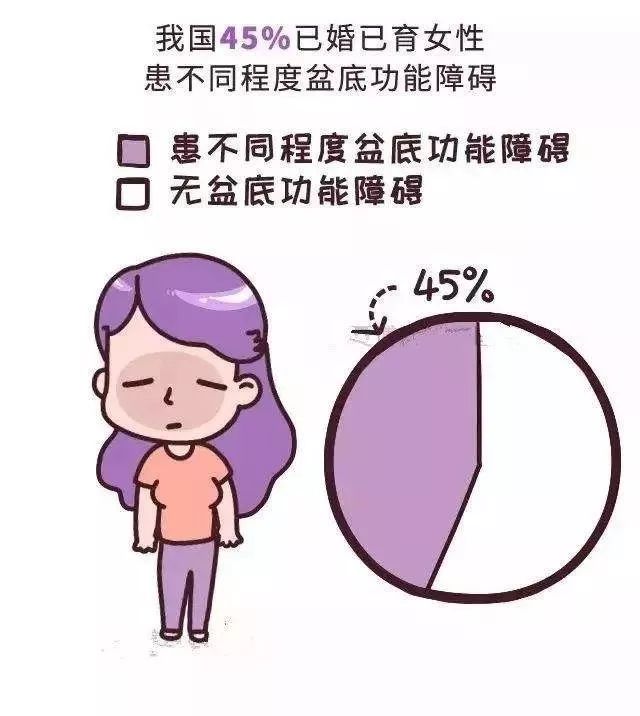 【大写的尴尬】大笑咳嗽时尿*禁失**了——四维超声带你认识盆底健康