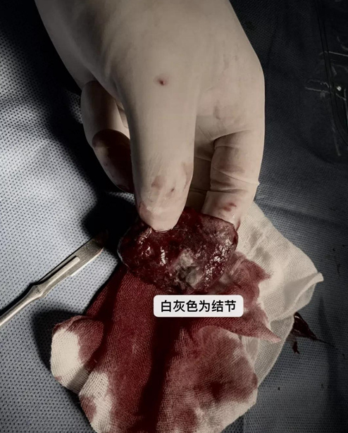 长期咳嗽咳不停怎么办,长期咳嗽要怎么调理