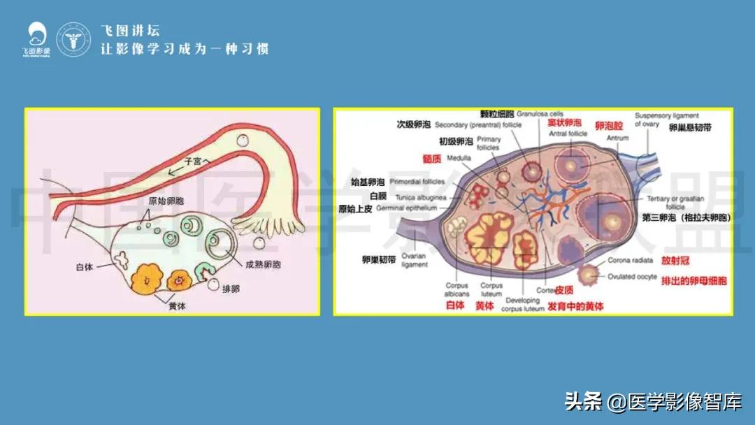 子宫解剖结构输卵管和卵巢位置,子宫附件ct影像学正常解剖表现