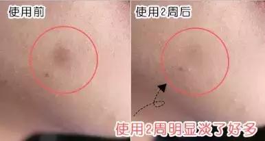 8款最好用护肤品推荐,价格亲民又特别好用的精华