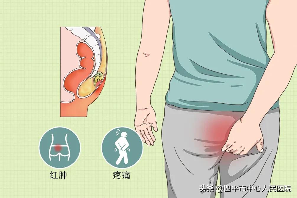 骶尾部肿块手术后发作,骶骨手术后疼痛