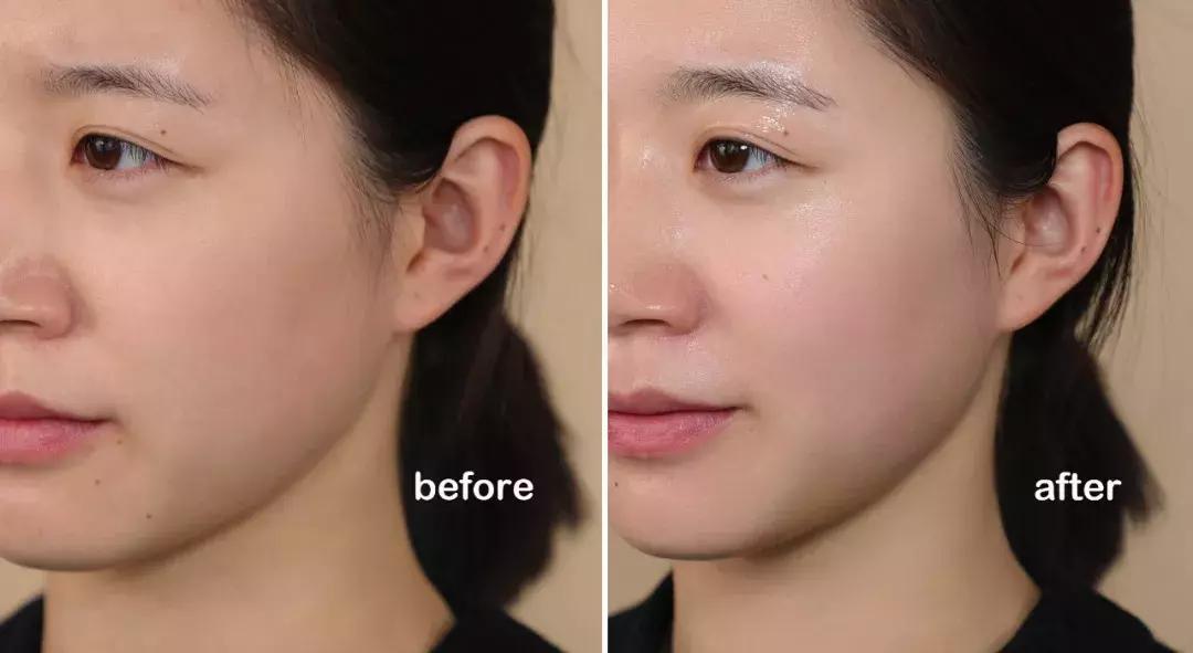 戚薇面部护肤方法,戚薇皮肤护理