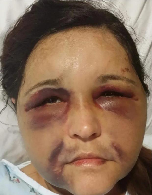 美国被殴打致死的女孩,华裔女子被丈夫殴打致死