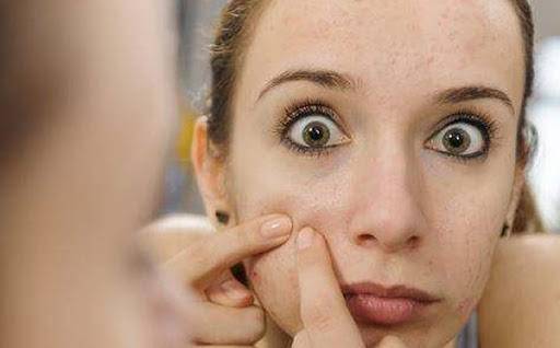 痘痘痘印的正确处理方法,痘痘留下的痘印应如何正确处理