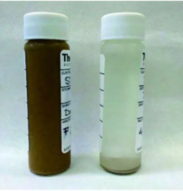 一人一年就产生近300斤粪便,全球70亿人的屎都去哪儿了?