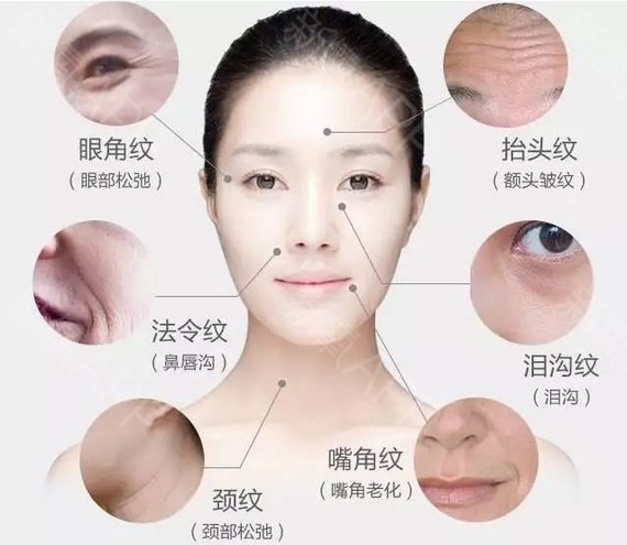 女人30岁脸上皱纹怎么除皱最安全,30岁的女人有皱纹有细纹怎么抗皱