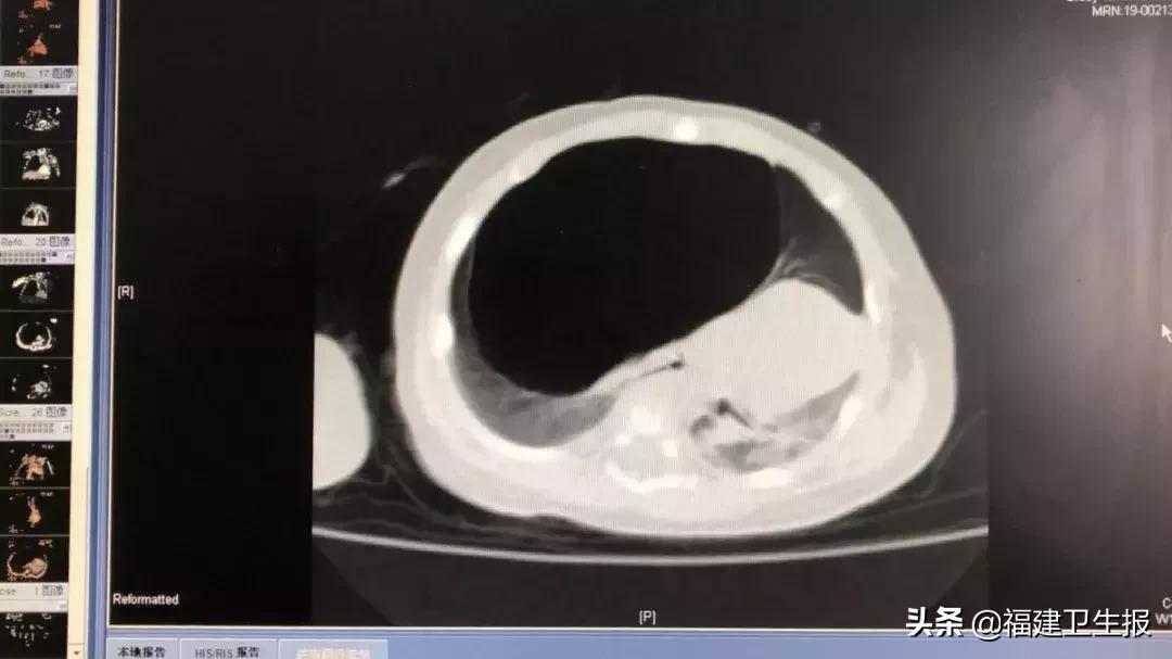 福建一2个月大*儿命婴**悬一线，只因父母疏忽了这件事！孕期一定要注意这些事