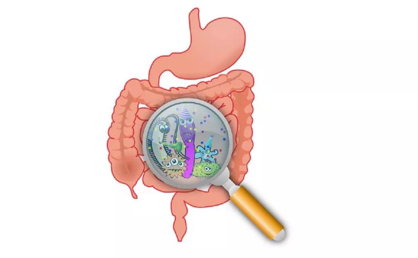 奶酪可以改善肠道吗,奶酪里有酵母菌